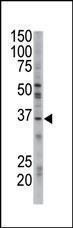 Anti-GGPS1 Rabbit Polyclonal Antibody (FITC (Fluorescein))