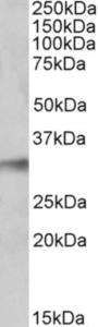 EB10520 (0.1 µg/ml) staining of Human Lung lysate (35 µg protein in RIPA buffer). Primary incubation was 1 hour. Detected by chemiluminescence.