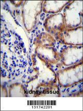 Anti-COL8A2 Rabbit Polyclonal Antibody (HRP (Horseradish Peroxidase))