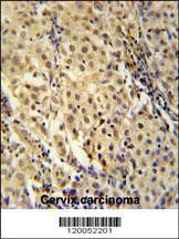 Anti-FOXC2 Rabbit Polyclonal Antibody (FITC (Fluorescein Isothiocyanate))