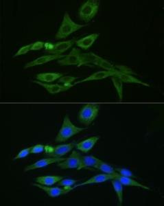 Immunofluorescence analysis of PC-12 using Donkey Anti-Rabbit IgG H&L Antibody (FITC) (A17343) at a dilution of 1:200 (40x lens). DAPI was used to stain the cell nuclei (blue)