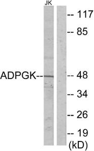 Western blot analysis of lysates from Jurkat cells using Anti-ADPGK Antibody. The right hand lane represents a negative control, where the antibody is blocked by the immunising peptide