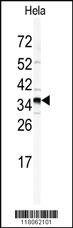 Anti-GOLPH3 Rabbit Polyclonal Antibody