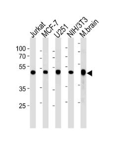 Anti-ENO1 Rabbit polyclonal antibody