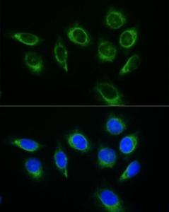 Immunofluorescence analysis of HeLa using Donkey Anti-Rabbit IgG H&L Antibody (FITC) (A17343) at a dilution of 1:200 (40x lens). DAPI was used to stain the cell nuclei (blue)