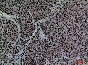 Anti-CD2 Rabbit Polyclonal Antibody