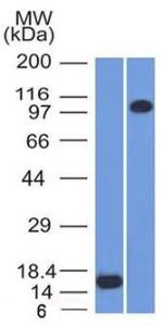 Western blot analysis of (A) recombinant Thrombomodulin protein and (B) THP1 cell lysate using Anti-Thrombomodulin Antibody [THBD/1591]