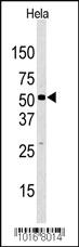 Anti-KDM4D Rabbit Polyclonal Antibody