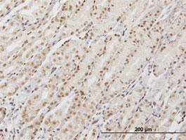 Anti-DDX54 Mouse Monoclonal Antibody [clone: 2E4]