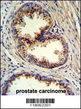 Anti-GOLPH3 Rabbit Polyclonal Antibody