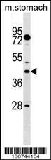 Anti-DUSP6 Rabbit Polyclonal Antibody (HRP (Horseradish Peroxidase))