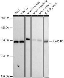 Western blot analysis of extracts of various cell lines, using Anti-Rad51D Antibody [ARC2800] (A307405) at 1:1,000 dilution. The secondary antibody was Goat Anti-Rabbit IgG H&L Antibody (HRP) at 1:10,000 dilution.