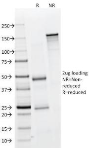 SDS-PAGE analysis of Anti-EpCAM Antibody [323/A3] under non-reduced and reduced conditions; showing intact IgG and intact heavy and light chains, respectively. SDS-PAGE analysis confirms the integrity and purity of the antibody.