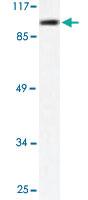 Anti-HDAC9 Rabbit Polyclonal Antibody