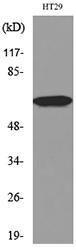 Western blot analysis of lysate from HT29 cells using Anti-CAT Antibody