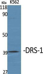 Western blot analysis of various cells using Anti-PECI Antibody