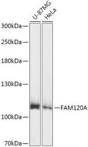 Western blot analysis of extracts of various cell lines, using Anti-FAM120A / OSSA Antibody (A307407) at 1:1,000 dilution. The secondary antibody was Goat Anti-Rabbit IgG H&L Antibody (HRP) at 1:10,000 dilution.