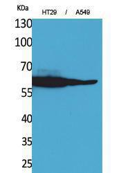 Western blot analysis of HT29, A549 cells using Anti-CAT Antibody