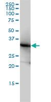 Anti-LDHB Mouse Monoclonal Antibody [clone: 2H6]