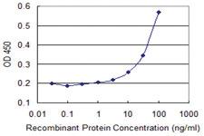 Anti-ZNF157 Mouse Monoclonal Antibody [clone: 3G3]