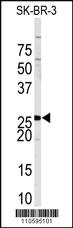 Anti-SPRY4 Rabbit Polyclonal Antibody