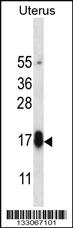 Anti-GPHB5 Rabbit Polyclonal Antibody