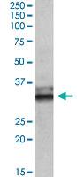 Anti-ETFA Goat Polyclonal Antibody