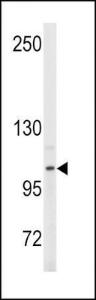 Anti-ENPP2 Rabbit polyclonal antibody