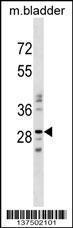 Anti-NUBPL Rabbit Polyclonal Antibody (Biotin)