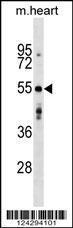 Anti-AGPAT9 Rabbit Polyclonal Antibody (APC (Allophycocyanin))