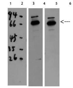 Western blot analysis of 293T HELA using Anti-CAT Antibody