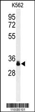 Anti-SPRY4 Rabbit Polyclonal Antibody