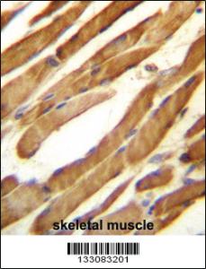 Anti-SLC16A10 Rabbit Polyclonal Antibody