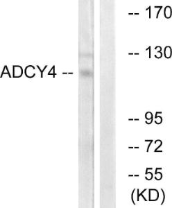 Western blot analysis of lysates from Jurkat cells using Anti-ADCY4 Antibody. The right hand lane represents a negative control, where the antibody is blocked by the immunising peptide