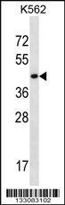 Anti-SLC16A10 Rabbit Polyclonal Antibody