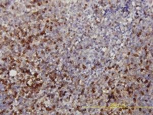 Anti-LDHB Mouse Monoclonal Antibody [clone: 2H6]