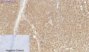 Immunohistochemical analysis of paraffin-embedded human liver tissue using Anti-CAT Antibody at 1:200 (4 °C overnight). Negative control was secondary Antibody only