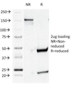 SDS-PAGE analysis of Anti-CD44v4 Antibody [CD44v4/1219] under non-reduced and reduced conditions; showing intact IgG and intact heavy and light chains, respectively SDS-PAGE analysis confirms the integrity and purity of the antibody