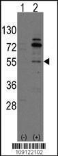 Anti-ARHGEF9 Rabbit Polyclonal Antibody (AP (Alkaline Phosphatase))