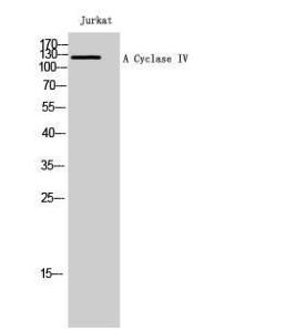 Western blot analysis of Jurkat cells using Anti-ADCY4 Antibody