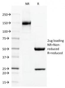 SDS-PAGE analysis of Anti-Thrombomodulin Antibody [THBD/1591] under non-reduced and reduced conditions; showing intact IgG and intact heavy and light chains, respectively. SDS-PAGE analysis confirms the integrity and purity of the antibody