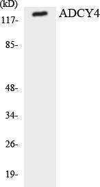 Western blot analysis of the lysates from 293 cells using Anti-ADCY4 Antibody