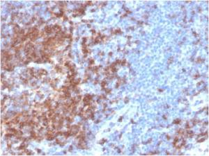 Immunohistochemical analysis of formalin-fixed, paraffin-embedded human spleen using Anti-CD22 Antibody [BLCAM/2637R]