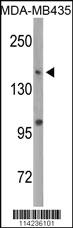 Anti-DNMT1 Rabbit Polyclonal Antibody