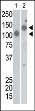 Anti-SARS virus Sn Rabbit Polyclonal Antibody