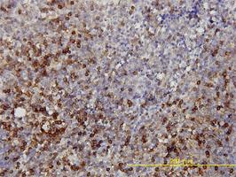 Anti-LDHB Mouse Monoclonal Antibody [clone: 2H6]