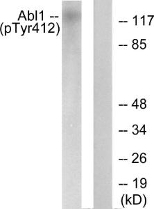 Western blot analysis of lysates from COS7 cells treated with Adriamycin 0.5ug/ml 24h using Anti-Abl (phospho Tyr412) Antibody. The right hand lane represents a negative control, where the antibody is blocked by the immunising peptide.