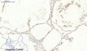 Immunohistochemical analysis of paraffin-embedded human lung tissue using Anti-CAT Antibody at 1:200 (4 °C overnight). Negative control was secondary Antibody only