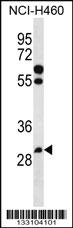 Anti-PGAP3 Rabbit Polyclonal Antibody