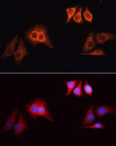 Immunofluorescence analysis of HeLa cells, using Goat Anti-Rabbit IgG H&L Antibody (TRITC, (A17346) as the primary Antibody at a dilution of 1:100. The cells were incubated with the primary Antibody overnight at 4 °C.